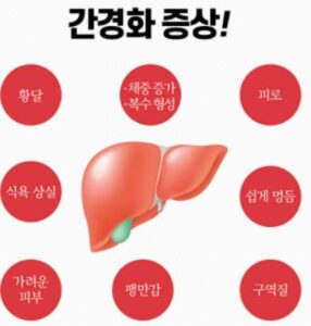 간경화 증상