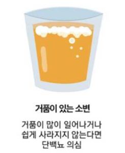 거품이 있는 소변