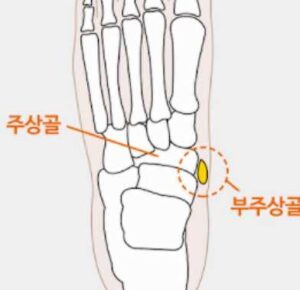 부주상골