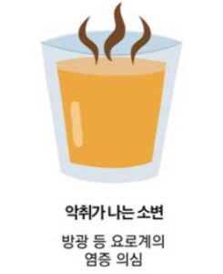 악취가 나는 소변