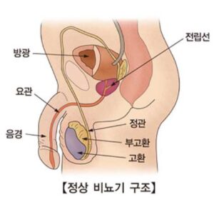 전립선비대증