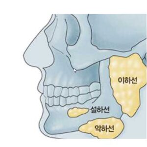 타석증