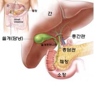 담낭 용종