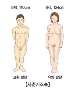 사춘기조숙