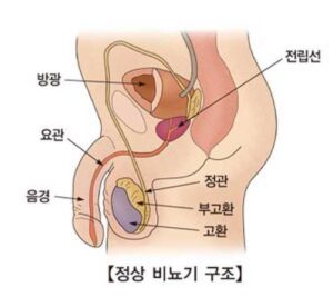 전립선암