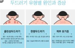 콜린성 두드러기 증상